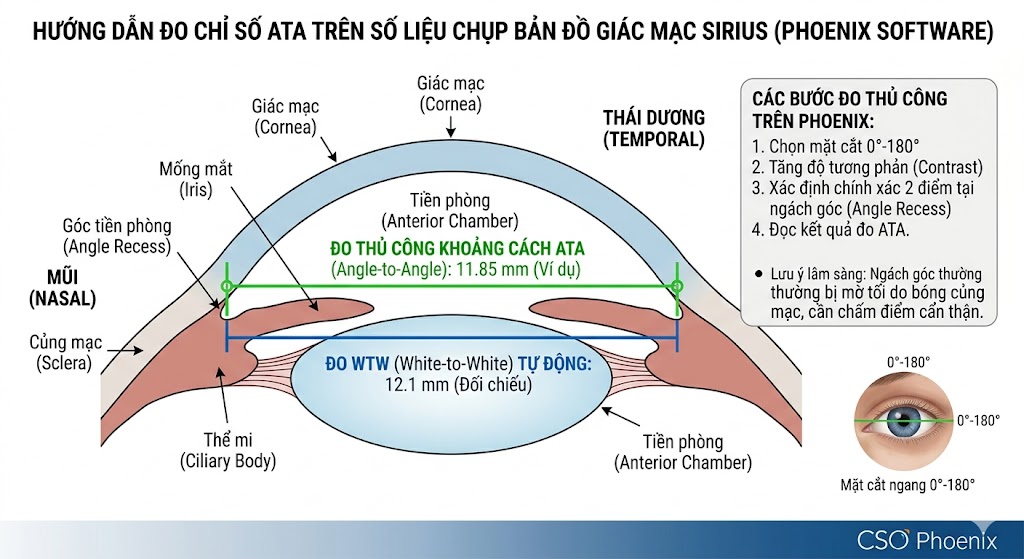 ATA measurement guide on Sirius